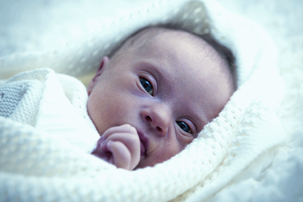Diagnosis for Down syndrome