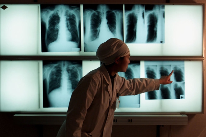 Without accurate diagnostics, clear treatment guidelines and improved control efforts, their effectiveness could be rapidly lost. (Reuters)