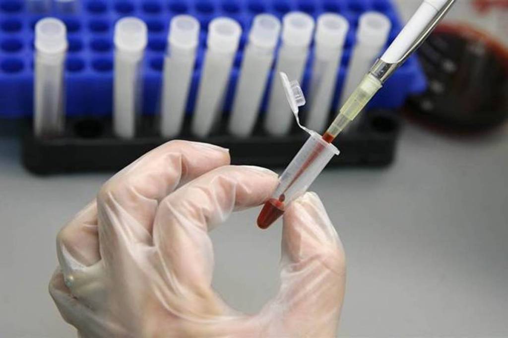 High mutation, the thumb rule is, helps the virus to survive longer by bringing down virulence. Against this backdrop, the present case is particularly worrying.