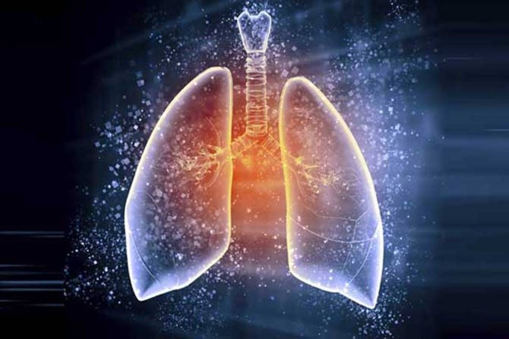 PostCOVID care Why the Lung needs more attention now, than ever