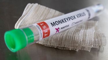 monkeypox, delhi, monkeypox india, viral infection