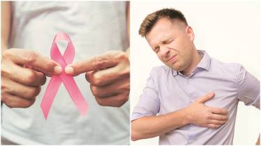 Breast cancer, Breast cancer disease, Breast cancer in man, Ductal carcinomas