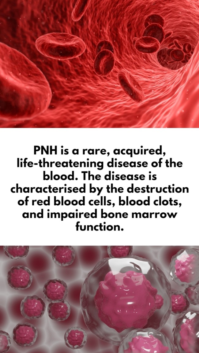 Novartis’ investigational drug for rare blood disorder: All you need to