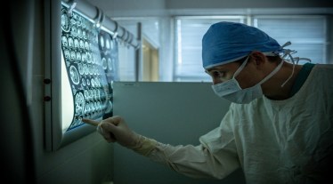 Alzheimer's Disease, sweetener, sugar alternative, Alzheimer's disease treatment, healthcare news,