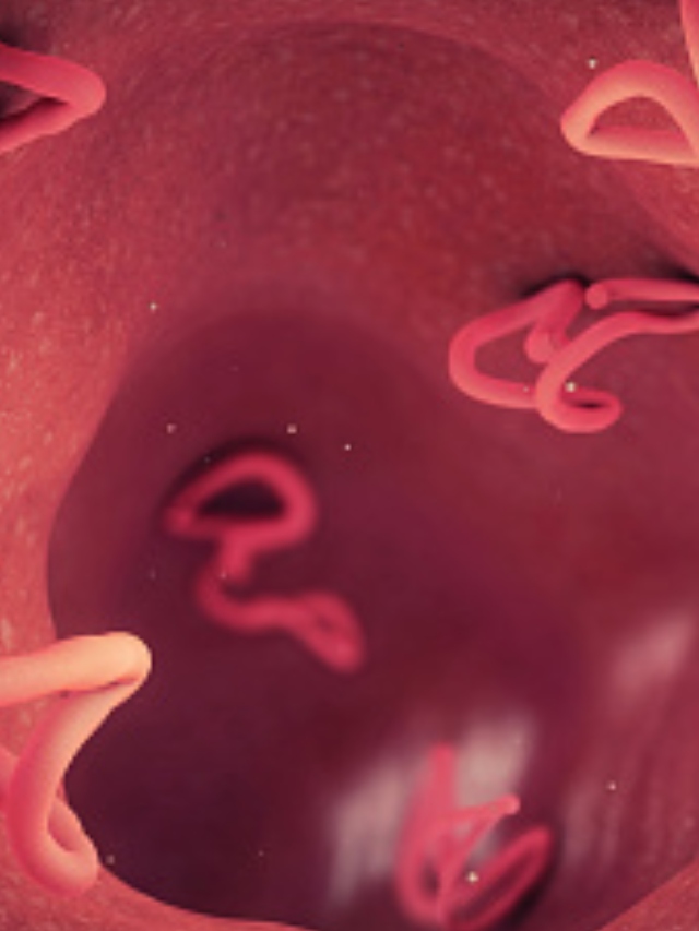 Worms found crawling under Spanish man’s skin All you need to know