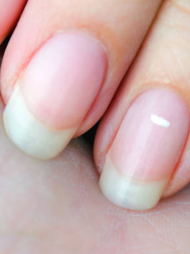 White spots on fingernails? Here’s what it means The Financial Express