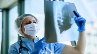 Tuberculosis, Tuberculosis report 2023, TB Diagnosis, TB treatment, TB news,