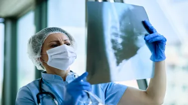 Tuberculosis, Tuberculosis report 2023, TB Diagnosis, TB treatment, TB news,