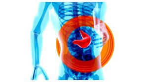 nafld, silent epidemic, liver disorders, healthcare