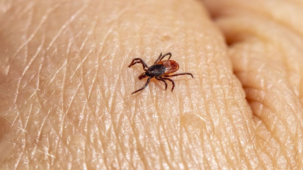 Crimean-Congo hemorrhagic fever, Crimean-Congo hemorrhagic fever virus, Ebola virus, bleeding eyes disease, Crimean-Congo hemorrhagic fever death, health news, wellness news,
