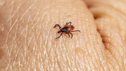 Crimean-Congo hemorrhagic fever, Crimean-Congo hemorrhagic fever virus, Ebola virus, bleeding eyes disease, Crimean-Congo hemorrhagic fever death, health news, wellness news,