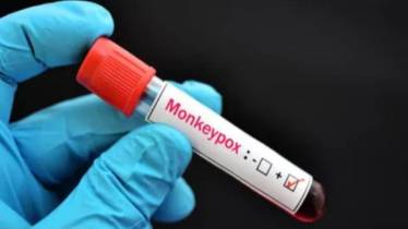 Mpox Outbreak
