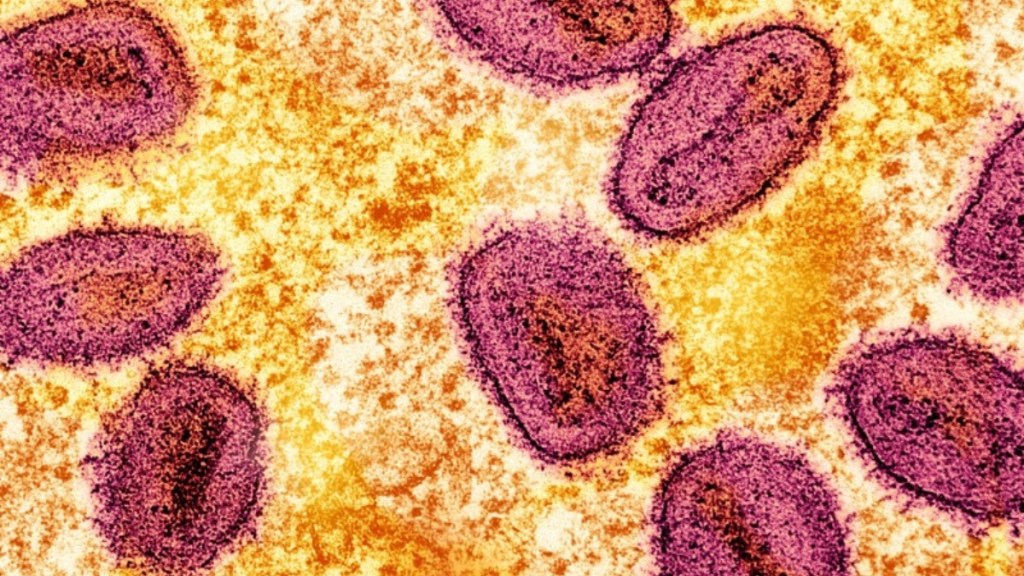 mpox, monkeypox, mpox India, mpox cases in india, india news, mpox cases, mpox latest updates