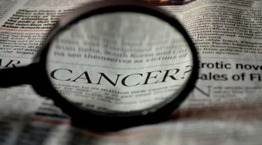 Cancer, cancer test, AI, cancer treatment, cancer diagnosis, healthtech, healthcare news, healthtech news,