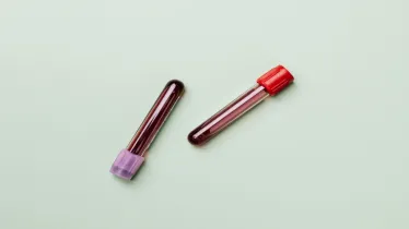 Blood-based biomarker tests the new frontier for Alzheimer’s diagnosis: GlobalData