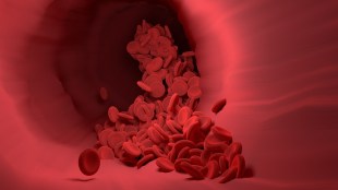 Microplastics, Microplastics in blood, brain disorders, heart disorders, microplastics side effects, microplastics harmful effects, health news, wellness news,