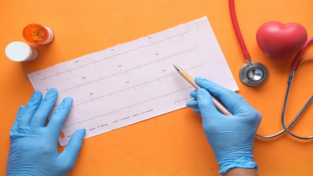 Heart Health, Heart Attack, Pacemaker, pacemaker for heart, cardiac care, health news, wellness news,