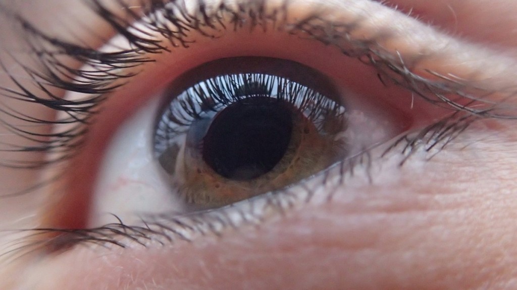 Glaucoma depression, glaucoma depression treatment, glaucoma depression Reddit, peripheral depression in glaucoma, can depression cause glaucoma, does glaucoma cause depression, glaucoma and depression medications, glaucoma drops and depression, glaucoma e depressione, can glaucoma eye drops cause depression, can stress make glaucoma worse, glaucoma and depression, do antidepressants make glaucoma worse, are any antidepressants safe with glaucoma, glaucoma and anxiety, glaucoma and antidepressants, the effect of anxiety and depression on progression of glaucoma, a glaucoma, is glaucoma a degenerative disease, B12 deficiency glaucoma, is glaucoma degenerative, can glaucoma cause depression, glaucoma crisis symptoms, does crying help glaucoma, is crying bad for glaucoma, c/d glaucoma, is vitamin D good for glaucoma, depression and glaucoma, is there any hope for glaucoma, H. pylori glaucoma, is glaucoma related to stress, does glaucoma have symptoms, is glaucoma symptoms, is glaucoma deadly, j glaucoma, can glaucoma cause anxiety, L-glutamine depression, glaucoma depth perception, what is MIGS for glaucoma, what antidepressants cause glaucoma, can you have low eye pressure and still have glaucoma, glaucoma and nortriptyline, glaucoma neuropathy, glaucoma dementia, open-angle glaucoma antidepressants, what is a bad eye pressure for glaucoma, optic nerve damage glaucoma symptoms, what is a bad pressure for glaucoma, quetiapine glaucoma, questions about glaucoma, does stress affect glaucoma, what causes glaucoma to worsen, glaucoma treatment Reddit, glaucoma stress related, r glaucoma, is glaucoma damage reversible, glaucoma and tricyclic antidepressants, glaucoma antidepressants, undiagnosed glaucoma, vitreous degeneration and glaucoma, glaucoma Zoloft, Zoloft glaucoma risk, Zoloft glaucoma Reddit, glaucoma 19, glaucoma 18, glaucoma pressure 28, glaucoma 1, glaucoma 2, 2 types of glaucoma, glaucoma 3, glaucoma 30, 4 stages of glaucoma, can glaucoma develop suddenly, 5 HTP glaucoma, 5 stages of glaucoma, glaucoma 80, glaucoma 9-year-old, health news,