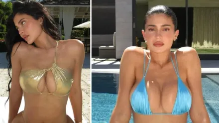 “445 cc, moderate profile, half under the muscle!!! silicone!!! garth fisher!!! hope this helps lol,” wrote Kylie