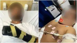 ‘I was trying to survive,’ Indian-origin man stabbed with Machete in Melbourne, hand reattached