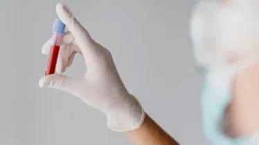 Doctor debunk myths of blood cancer