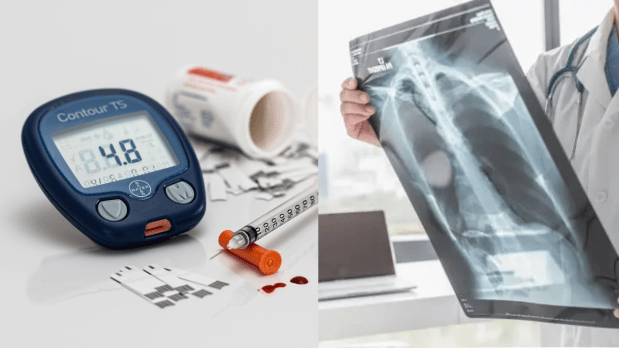  Number of cases: India reported an estimated 3.15 lakh TB-related deaths in 2024. accounting for 29 per cent of the deaths globally. The burden of diabetes is also consistently increasing in the country, with over 100 million people currently living with the disease. (Photo Source: Canva)