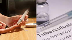 New study reveals how diabetes can worsen TB to cause treatment failure and even death