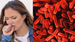 What is legionnaires disease? Two dead, 58 affected in Harlem over the spread of this bacterial infection