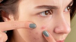 Can Vitamin D deficiency trigger acne, eczema, and other skin issues? Dermatologist answers