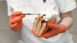 How Ozempic affects your teeth: Dentists warn of a new side effect of weight loss medication, offer tips